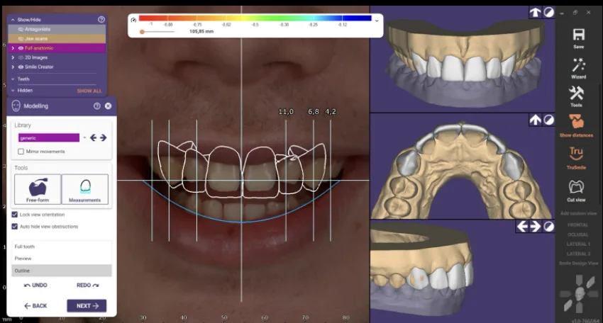 Autran Dental Academy: Il Metodo Fernando Autran per l’Odontoiatria Estetica